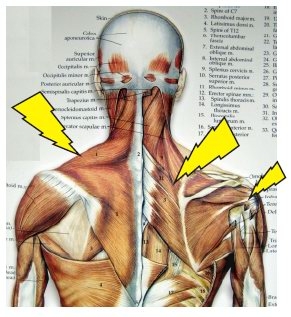 本頁圖片/檔案 - Slump_back_2013_back%20muscles