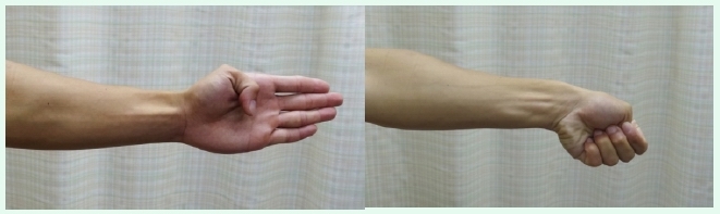 本頁圖片/檔案 - UL_7_thumb_flexor